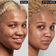 NIACINAMIDE OIL CONTROL SERUM (SUERO FACIAL)